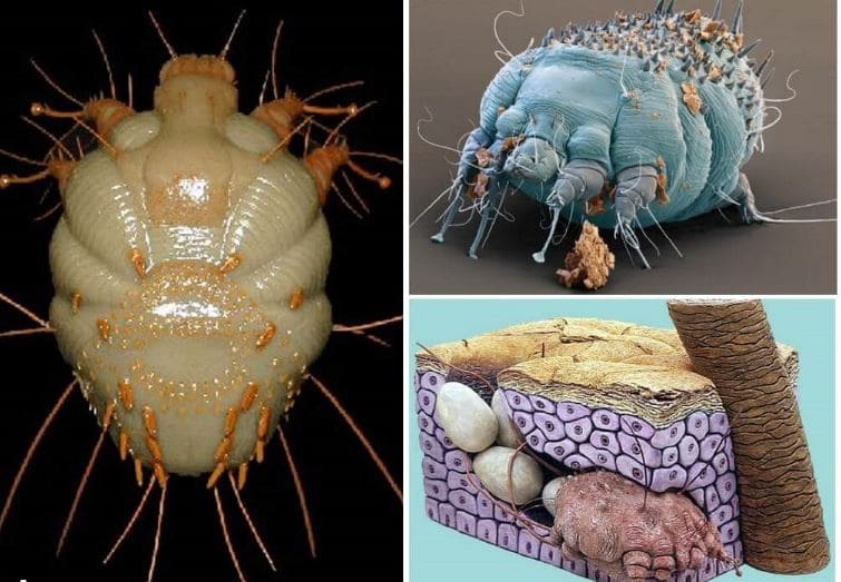 Дезинфекция при чесотке